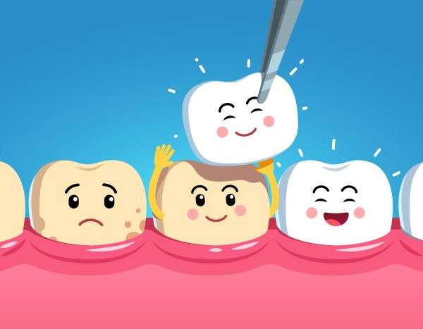 Reasons To Get Dental Veneers